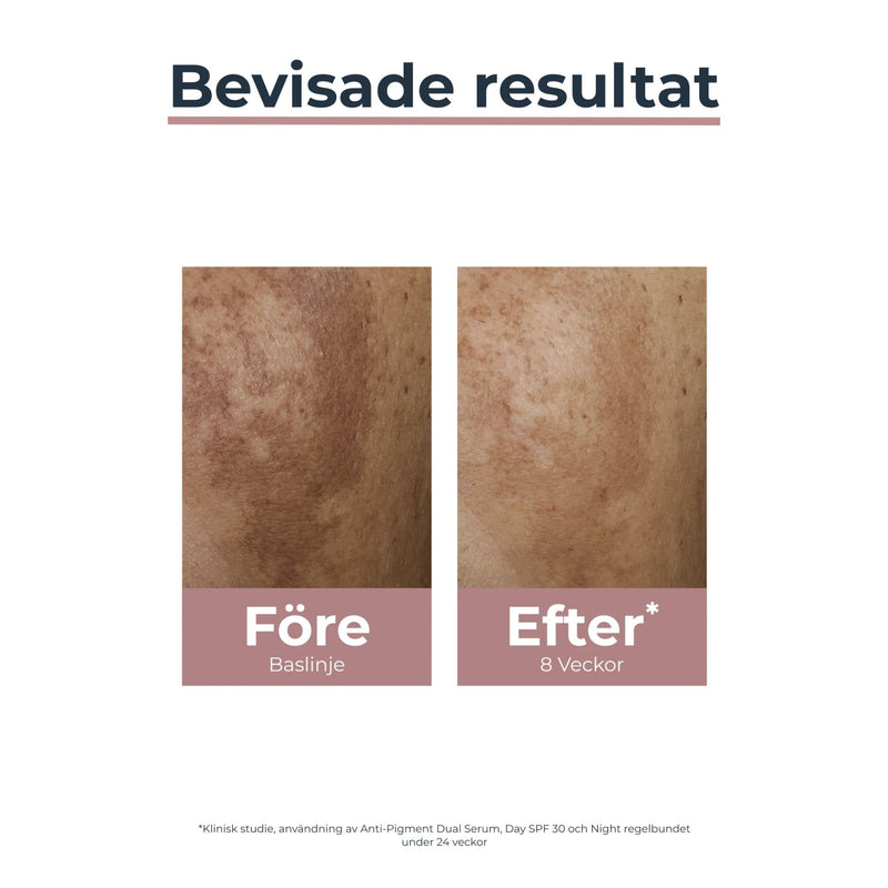 Eucerin Anti-Pigment Day Care Spf 30 50 ml